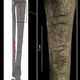 Image for article titled 3,000-Year-Old Murder Mystery Solved: Shark Attack